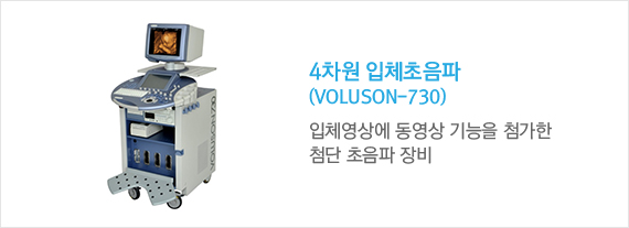 4차원 입체초음파