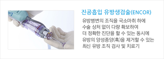 유방생검술